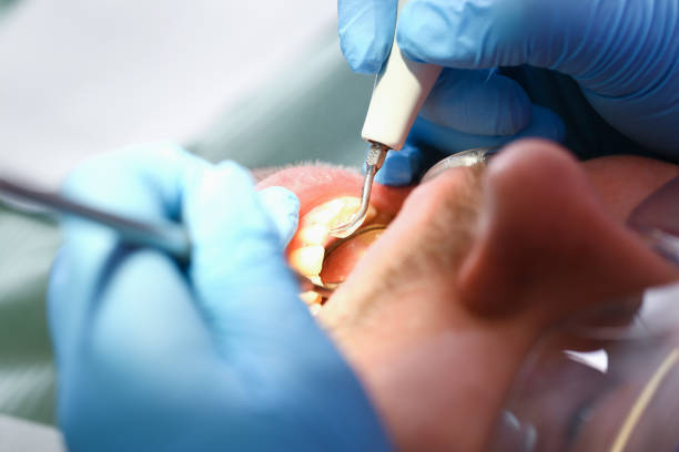 Best Knocked-Out Tooth Emergency  in Statesville, NC