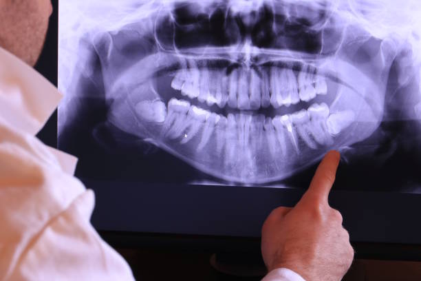 Best Cracked Tooth Emergency Dentist  in Statesville, NC