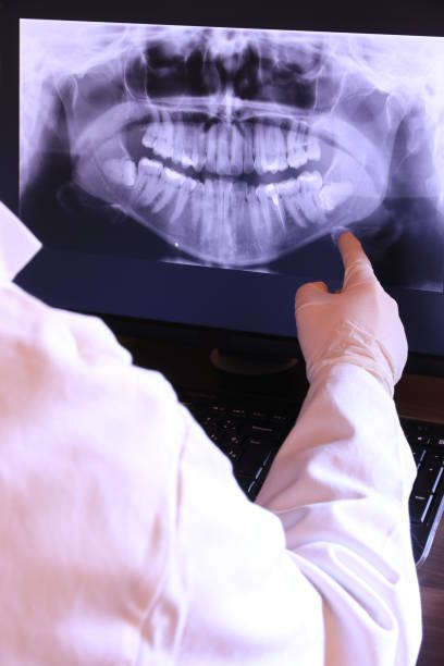 Best Root Canal Emergency Dentist  in Statesville, NC